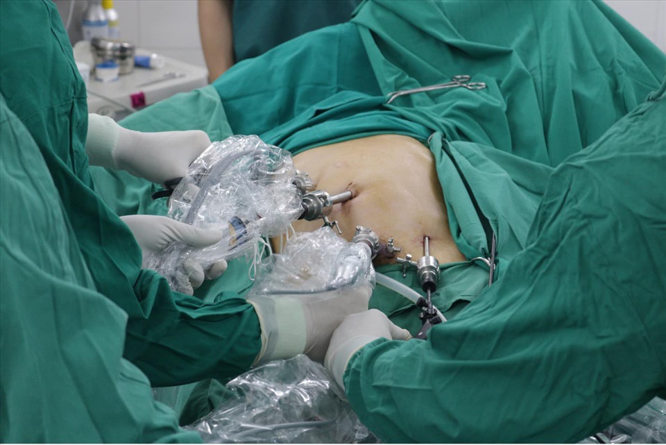 Ca phẫu thuật cắt bỏ đoạn ruột chứa khối u. Nguồn ảnh: Bệnh viện Hữu nghị Việt Tiệp