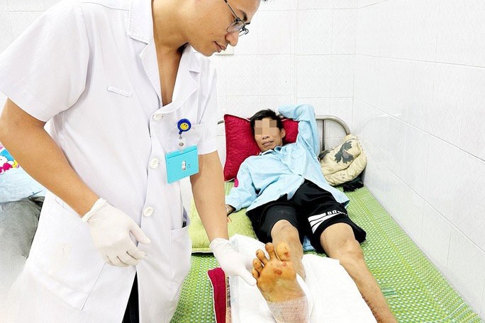 Nối thành công bàn chân bị máy cưa cắt đứt cho bệnh nhân. Ảnh: Bệnh viện cung cấp