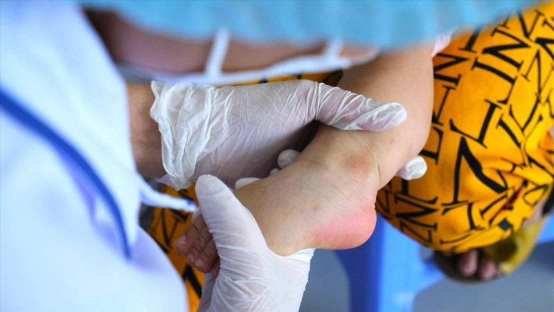 Trẻ mắc tay chân miệng gia tăng ở ĐBSCL gia tăng, Sở Y tế TP Cần Thơ lên phương án ứng phó với nguy cơ thiếu thuốc điều trị. Ảnh: Phong Linh