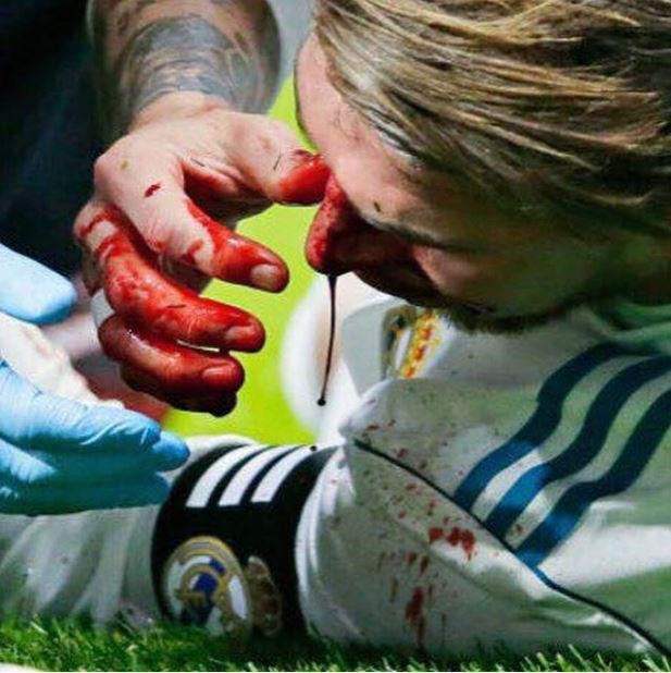 Ramos đổ gục xuống sân trong trận đấu với Athletico Madrid.