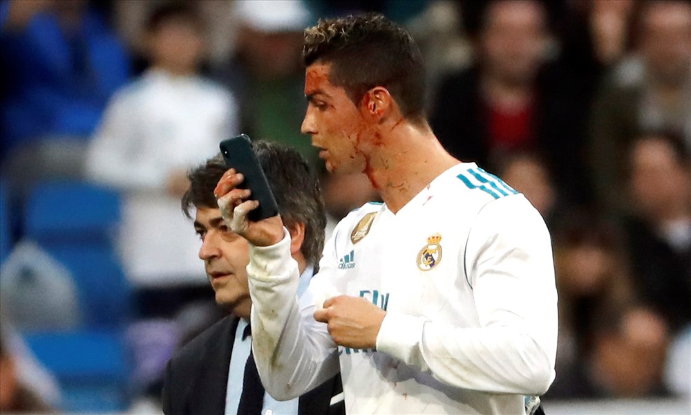 Khuôn mặt của Ronaldo sau khi nỗ lực hoàn tất cú đúp cho riêng mình. Ảnh: The Guardian.