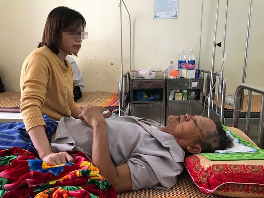 Ông Đắc bị thương nặng và đang được điều trị tại Trung tâm Y tế huyện Phù Cừ.