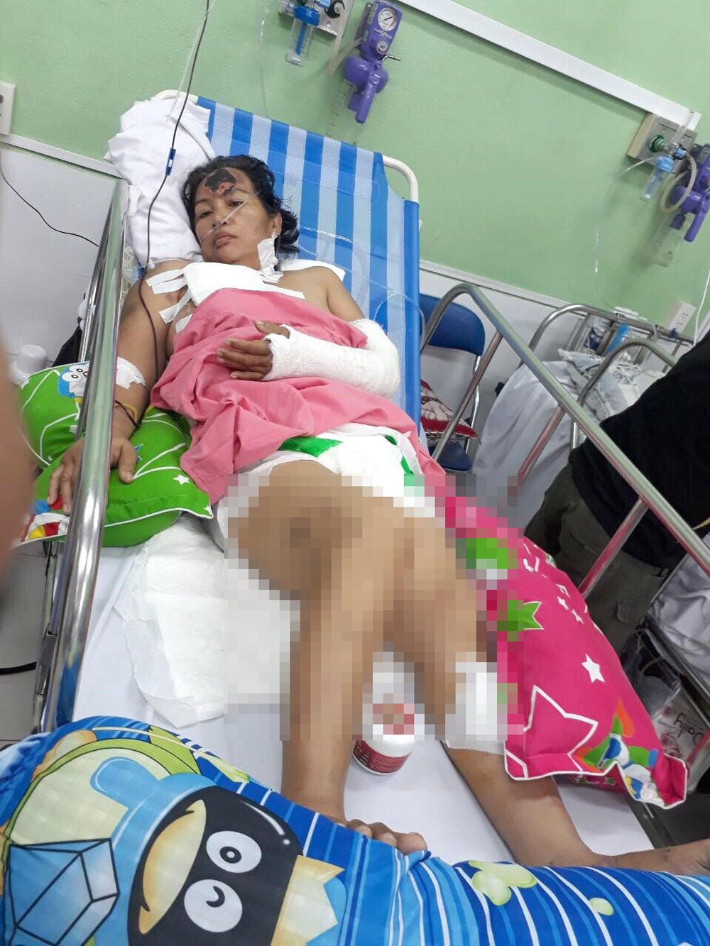 Bà Diệu An nằm điều trị tại Bệnh viện (BV) Chợ Rẫy (TPHCM) trong tình trạng nguy kịch.