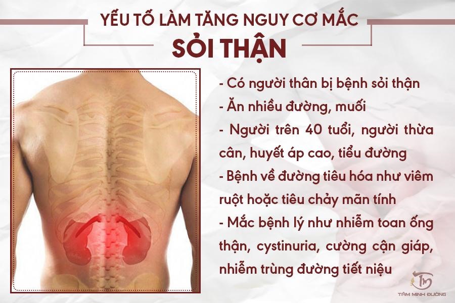 Triệu chứng bị sỏi thận: Những dấu hiệu cần biết và cách phòng ngừa