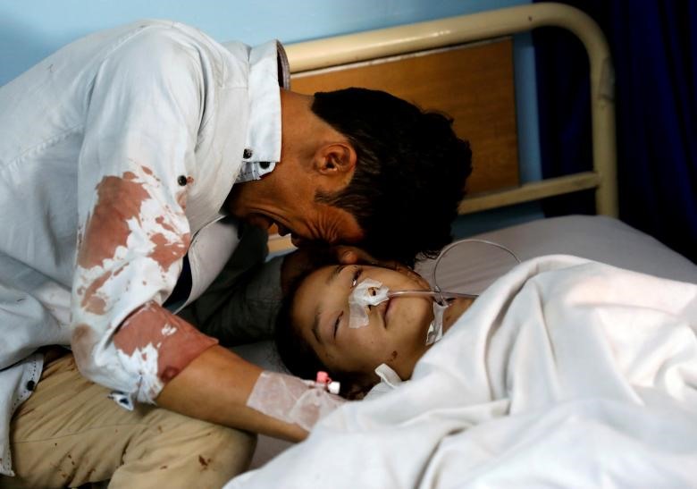 Một người đàn ông khóc bên cạnh cô con gái bị thương tại bệnh viện sau vụ tấn công tự sát ở Kabul, Afghanistan, ngày 22.4.2018.