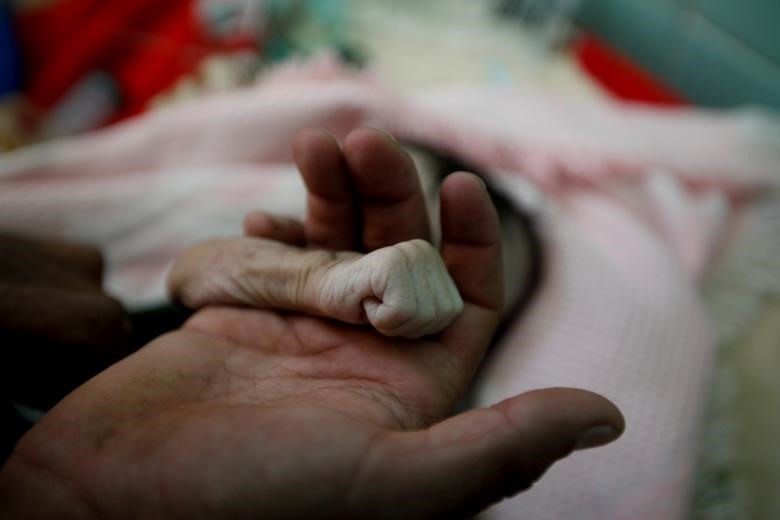 Saleh Hassan al-Faqeh nắm tay cô con gái 4 tháng tuổi của mình tên là Hajar. Cô bé đã chết vì suy dinh dưỡng tại bệnh viện al-Sabeen ở Sanaa, Yemen, ngày 15.11.2018. Fouad al-Reme, một y tá ở Bệnh viện Sabeen cho biết, Hajar đã tỉnh táo khi đến bệnh viện nhưng cô bé bị thiếu oxy, ” Cơ thể cô bé lúc ấy hốc hác, chỉ còn da bọc xương“, anh nói.