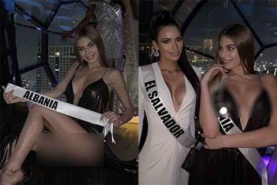 Người đẹp Albania bị chỉ trích vì khoe thân phản cảm ở Hoa hậu Hoàn vũ.