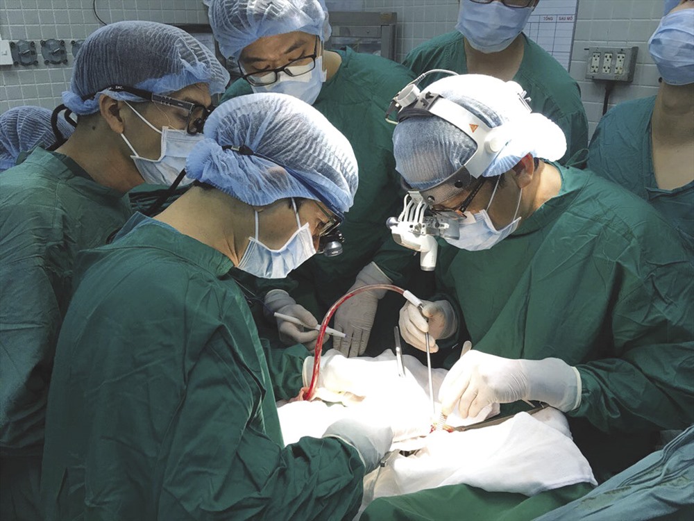 Một ca phẫu thuật ghép tim tại BV Chợ Rẫy từ nguồn tạng được hiến - Ảnh: K'LIEP