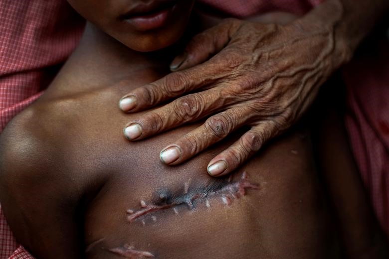 Mohammed Shoaib, 7 tuổi, bị bắn vào ngực trước khi vượt biên từ Myanmar hồi tháng 8, đang được cha của cậu bé đỡ lấy ở bên ngoài trung tâm y tế gần Cox's Bazar, Bangladesh, ngày 05/11/2017. (Ảnh: Reuters)