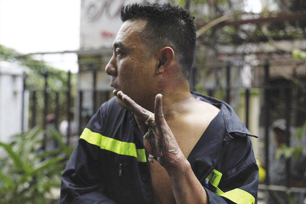 Bàn tay bị phỏng rộp của một chiến sĩ cứu hỏa tham gia chữa cháy trong vụ cháy Carina. Ảnh: VTV24