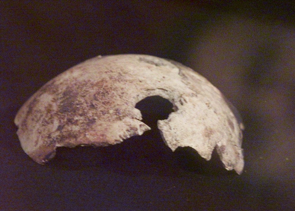 Mảnh xương sọ được cho là của Hitler, với một lỗ thủng khả năng do đạn bắn.