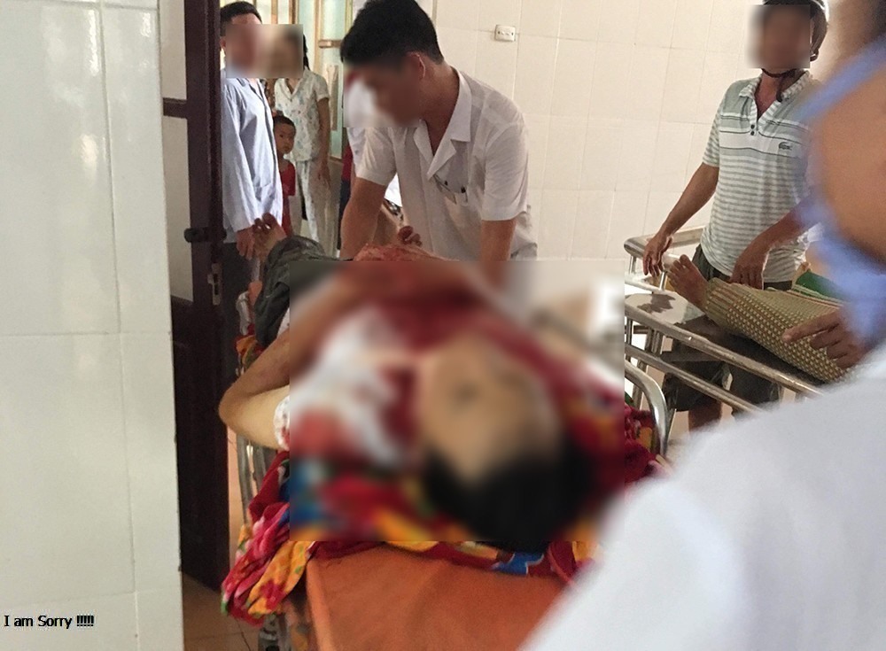 Ông Chiệu vẫn đang nằm cấp cứu tại Bệnh viện Việt Đức trong tình trạng nguy kịch với vết thương khá nặng.