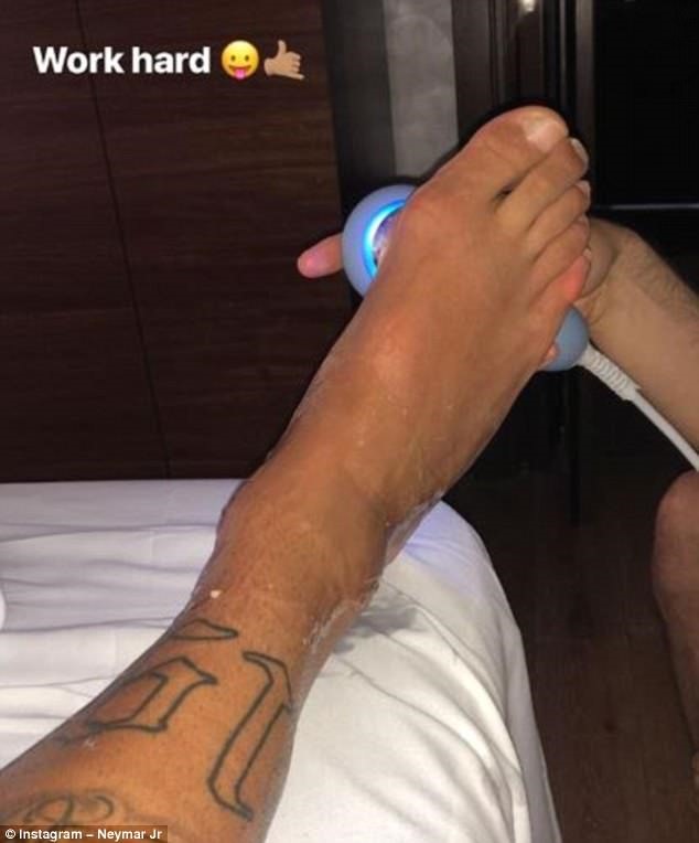 Neymar đăng tải hình ảnh chân đau trên Instagram.