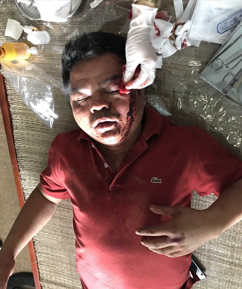 Sau khi bị đánh, anh Khanh bị thương khá nặng, mất nhiều máu. 
