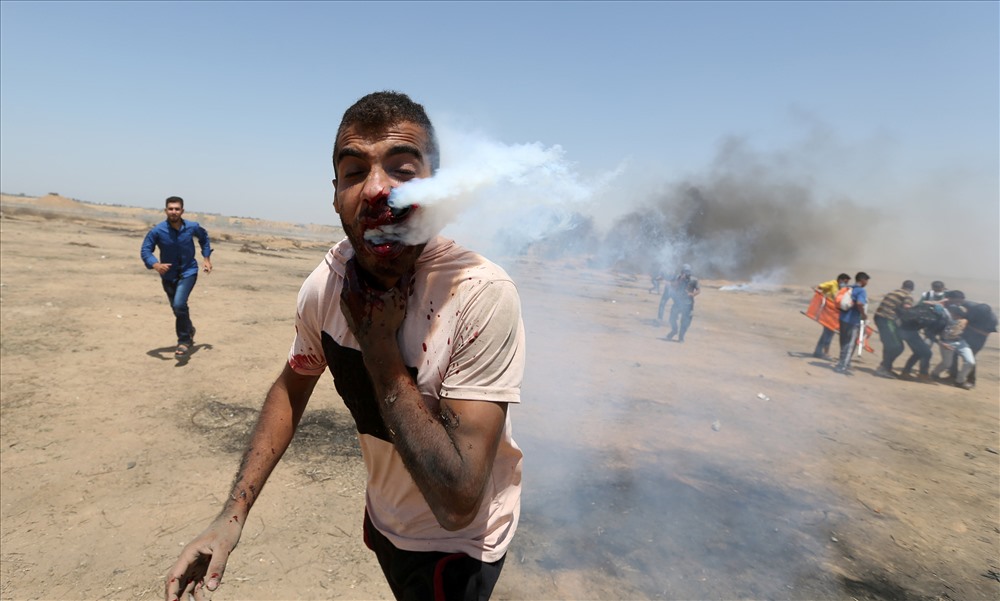 Một người đàn ông bị chiếc hộp đựng hơi nước găm vào mặt trong một cuộc biểu tình ở phía đông thị trấn Khan Younis, Palestine.