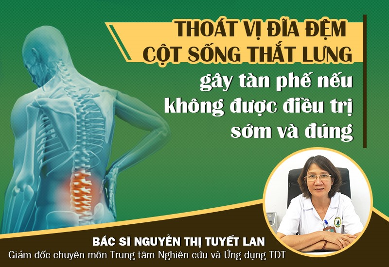 Thạc sĩ - Bác sĩ Nguyễn Thị Tuyết Lan cảnh báo mức độ nguy hiểm của bệnh thoát vị đĩa đệm cột sống thắt lưng