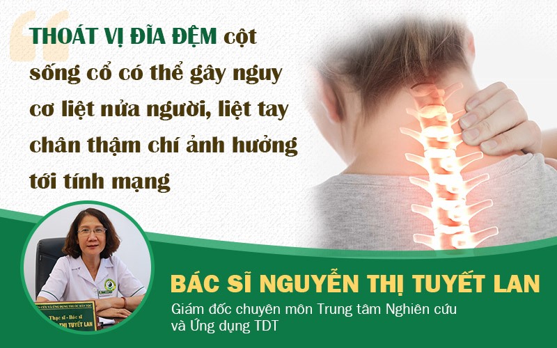 Bác sĩ Nguyễn Thị Tuyết Lan nói về bệnh thoát vị đĩa đệm cột sống cổ 