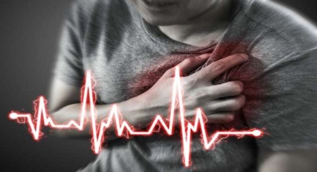 Đau tim có thể gây tử vong nhanh không kịp trở tay.