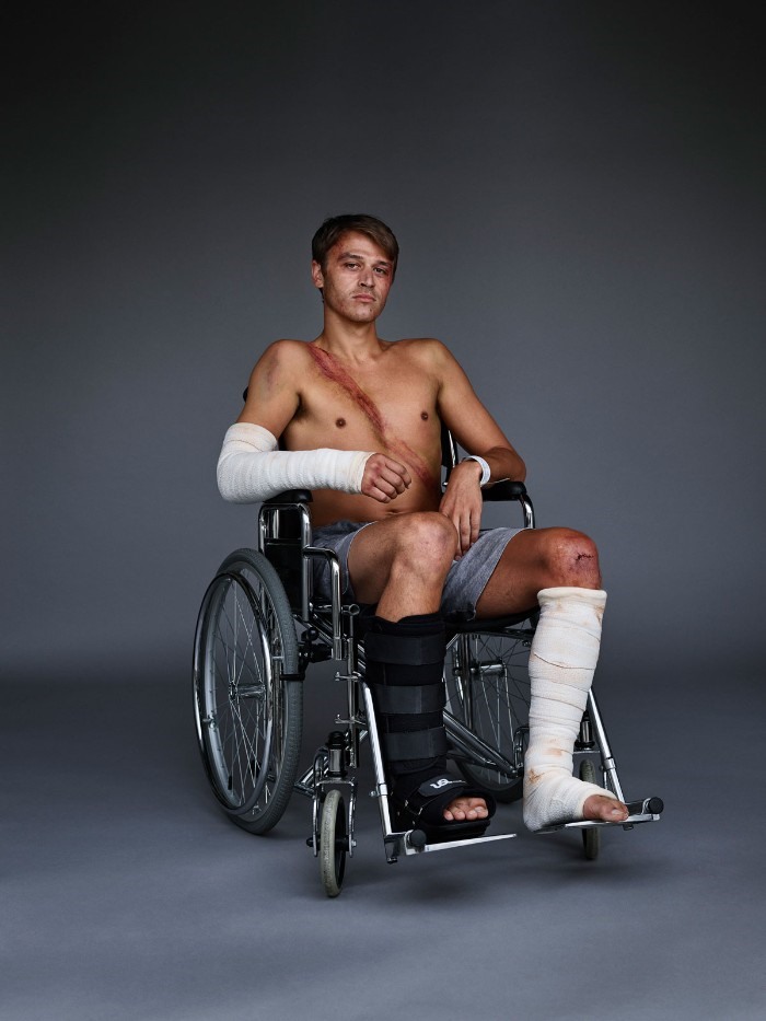James Liberona (trong ảnh) được nhìn thấy trên chiếc xe lăn và bị đa chấn thương do tai nạn xe hơi hồi năm 2014
