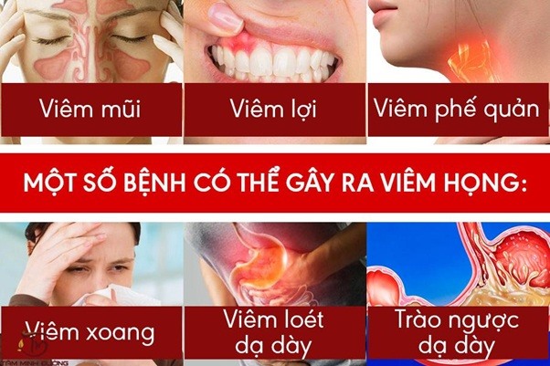 Một số bệnh lý hình thành và làm gia tăng tình trạng viêm ở cổ họng bệnh nhân