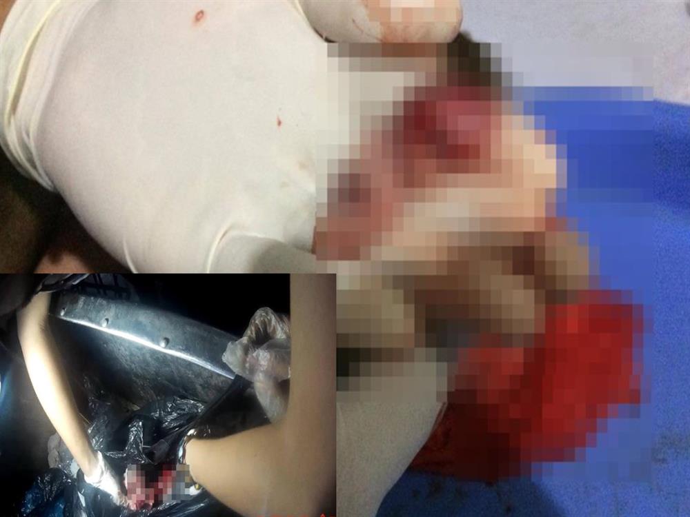 Thai nhi | LAODONG.VN