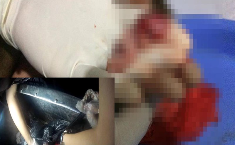 Thai nhi | LAODONG.VN