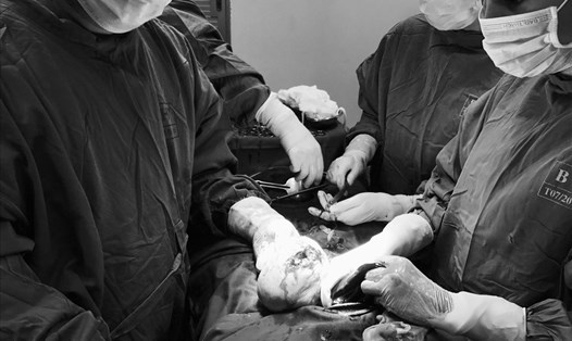 Các bác sĩ Bệnh viện Hùng Vương thực hiện ca mổ bắt con (ảnh T.C)