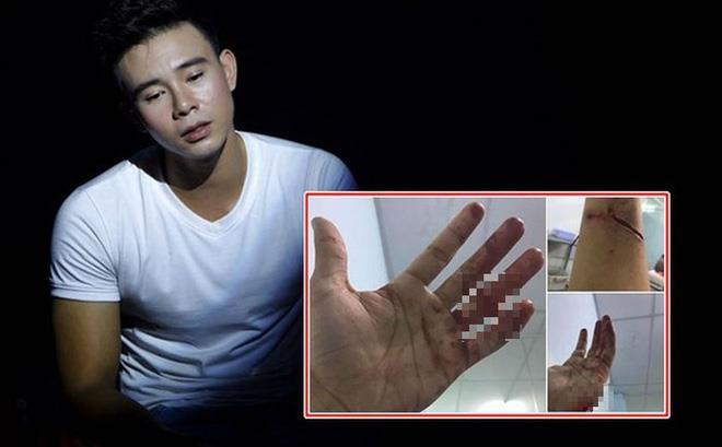 Do xô xát với chủ nợ của mẹ, Đông Hùng bị chém rách tay. Ảnh: FBNV