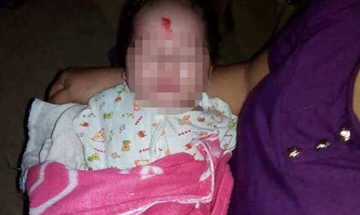 Bé gái hơn 2 tháng tuổi bị mẹ bỏ rơi (ảnh NDCC)