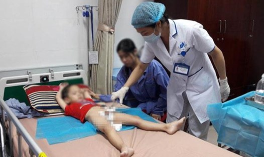 Bệnh nhi ở Hưng Yên được chữa trị miễn phí tại Bệnh viện Da liễu Trung ương. Ảnh: Thùy Linh