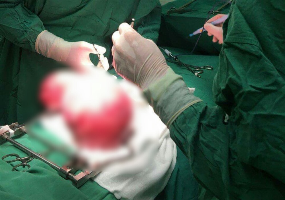 Các bác sĩ tiến hành phẫu thuật