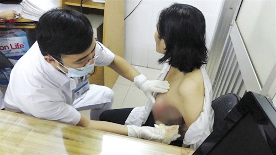 Một bệnh nhân ung thư vú đang được bác sĩ thăm khám.
