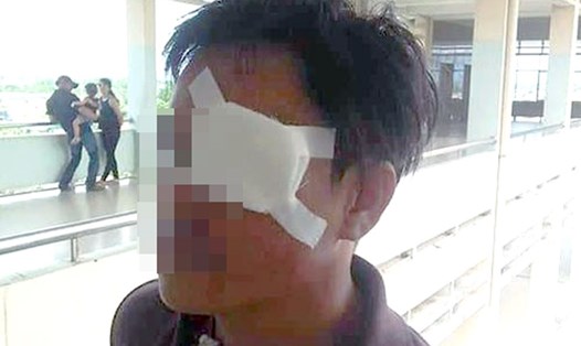 Nạn nhân Lê Tấn Sinh bị kẻ cho vay nặng lãi đâm mù mắt ngày 23.8.2018. Ảnh: C.A.
