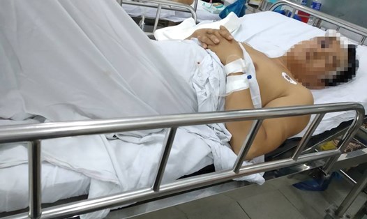 Anh Minh đang được điều trị tại Bệnh viện Đa khoa tỉnh Quảng Nam. Ảnh: Đ.V