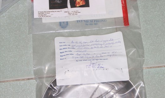 Các dụng cụ y tế nạo phá thai tại nhà của bà Vũ Thị Lâm (ngụ phường Thanh Sơn, TP Phan Rang - Tháp Chàm).
