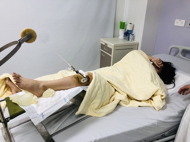 Chị Trang đang được điều trị tại Bệnh viện Trung ương Quân đội 108. Ảnh: Vũ Văn Tiến.