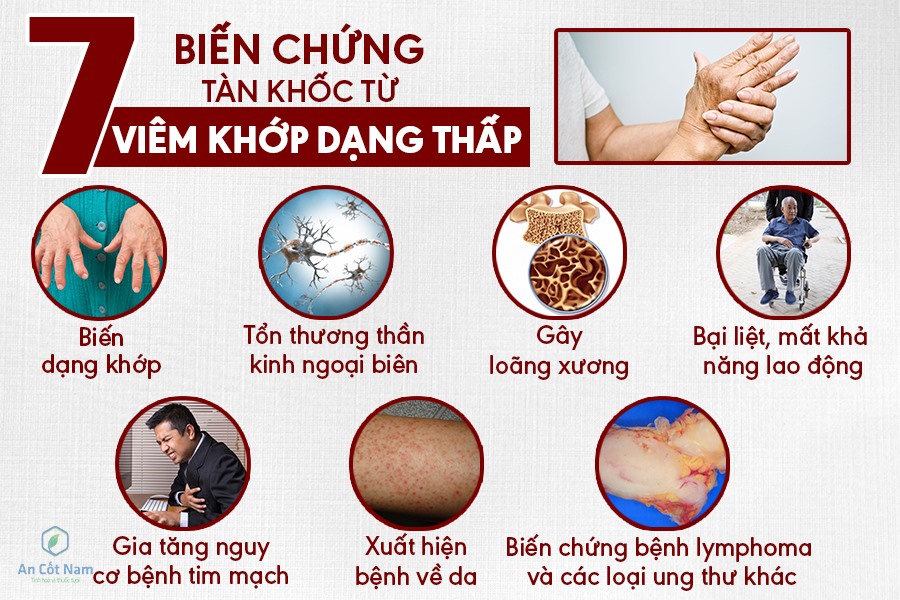 7. Cách Phòng Ngừa Viêm Khớp Dạng Thấp