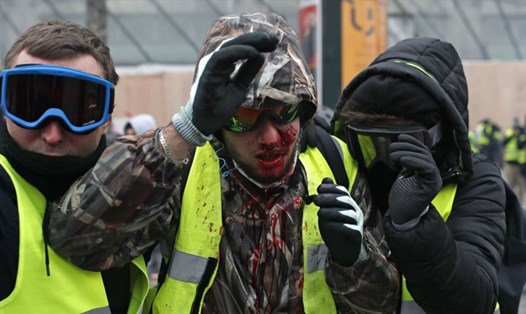 Một người biểu tình bị thương khi đụng độ với cảnh sát chống bạo động ở Paris, ngày 8.12. 2018. Ảnh: AP