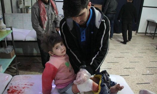 Một bé gái Syria bị thương được điều trị sau các vụ không kích vào Đông Ghouta. Ảnh: AFP