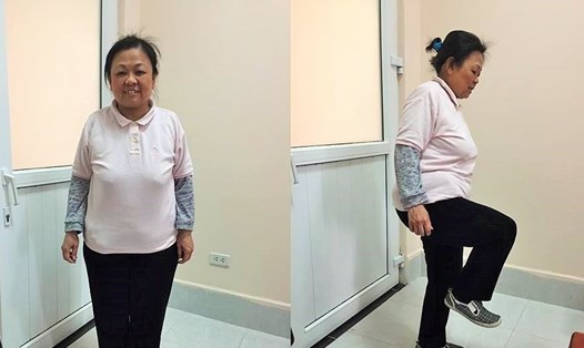 Bệnh nhân D vui vẻ sau khi chữa khỏi bệnh khiến bà khổ sở suốt 20 năm (Ảnh: BVCC)
