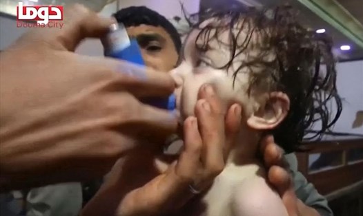 Một em bé được điều trị sau vụ tấn công nghi là hóa học ở Douma hôm 7.4. Ảnh: Sky News