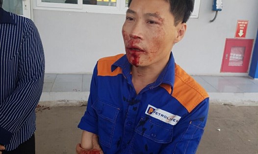 Anh Bùi Vinh Quang bị đánh đổ máu. Ảnh: CTV