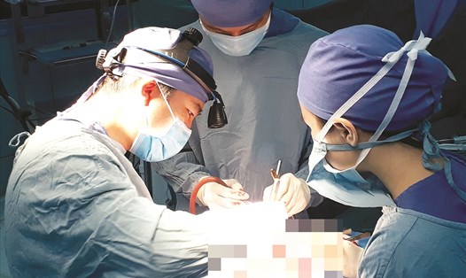Phẫu thuật tạo hình hộp sọ.
