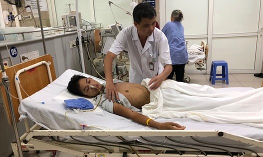 Bệnh nhân bị ong đốt đang điều trị tại Bệnh viện Bạch Mai, Hà Nội.