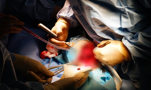 Các y bác sĩ đã ứng dụng kỹ thuật truyền máu hoàn hồi (Cell Saver) trong quá trình phẫu thuật cho bệnh nhân