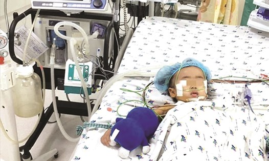 Bé gái hơn 2 tuổi được cứu sống nhờ PP trao đổi khí không cần tim, phổi.