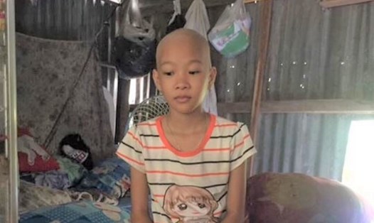 Cháu Nguyễn Thị Kim Ngân bị bệnh bướu
ác tính giai đoạn III đang điều trị hóa chất.

Ảnh: THÀNH NHÂN
