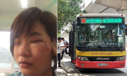 Chị Đỗ Thúy Hinh, công nhân phụ xe buýt bị hành hung ngày 20.10 ở Hà Nội.