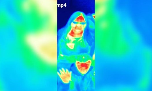 Bức ảnh nhiệt của Bal Gill ghi lại một hình khối nhiệt ở ngực phải. Ảnh: CNN