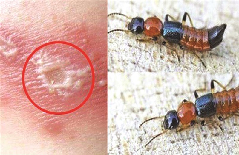 Cần xử lý đúng cách khi kiến ba khoang có độc tố mạnh “tấn công”